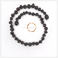 Adult Cherry Amber Anklet         (Amber Therapy)