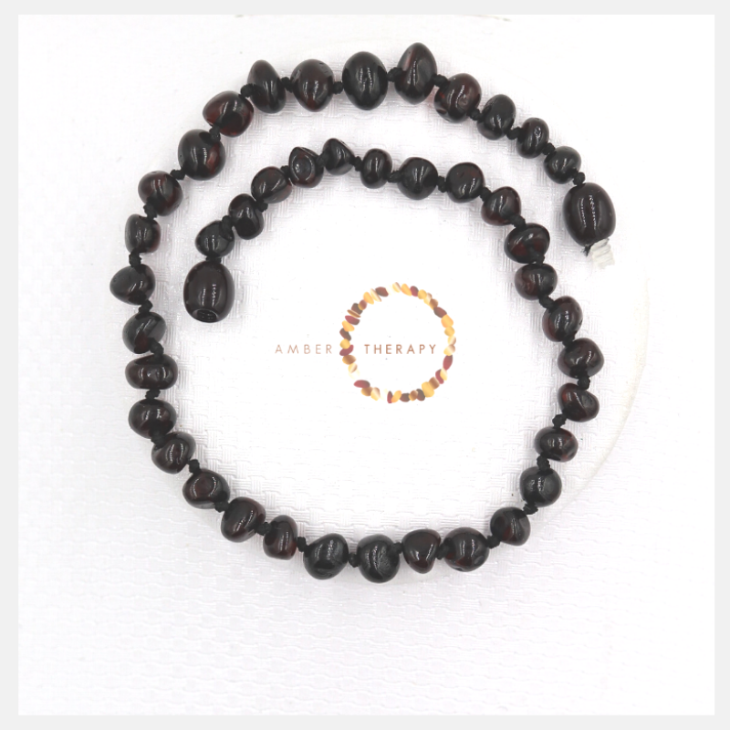 Adult Cherry Amber Anklet         (Amber Therapy)